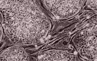 Human embryonic stem cells